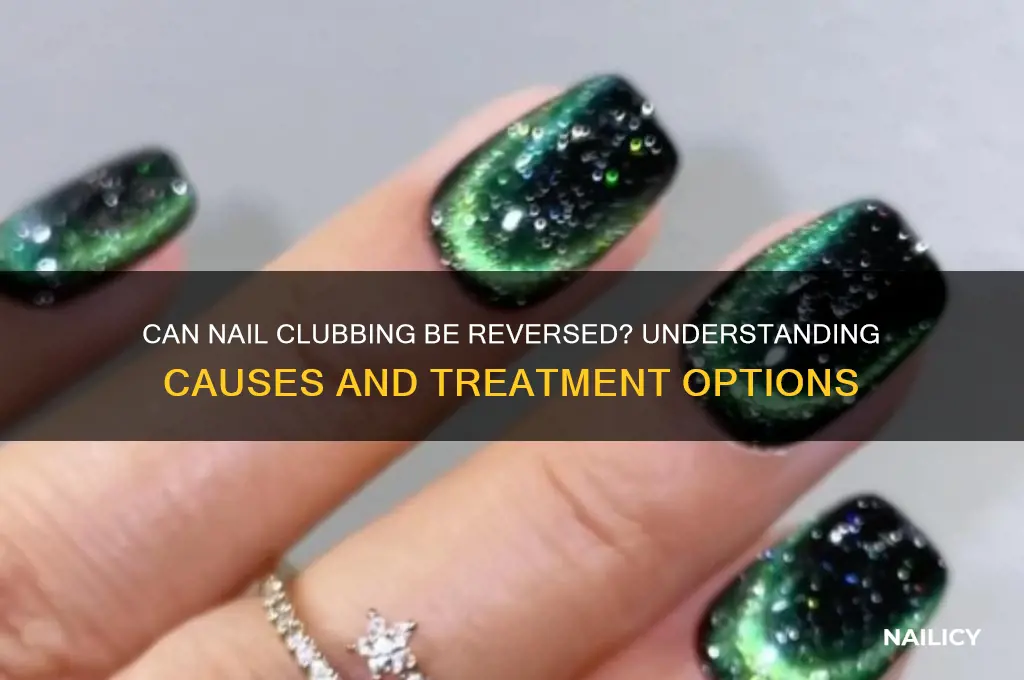 does nail clubbing go away