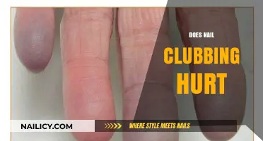 Does Nail Clubbing Cause Pain? Understanding Symptoms and Concerns