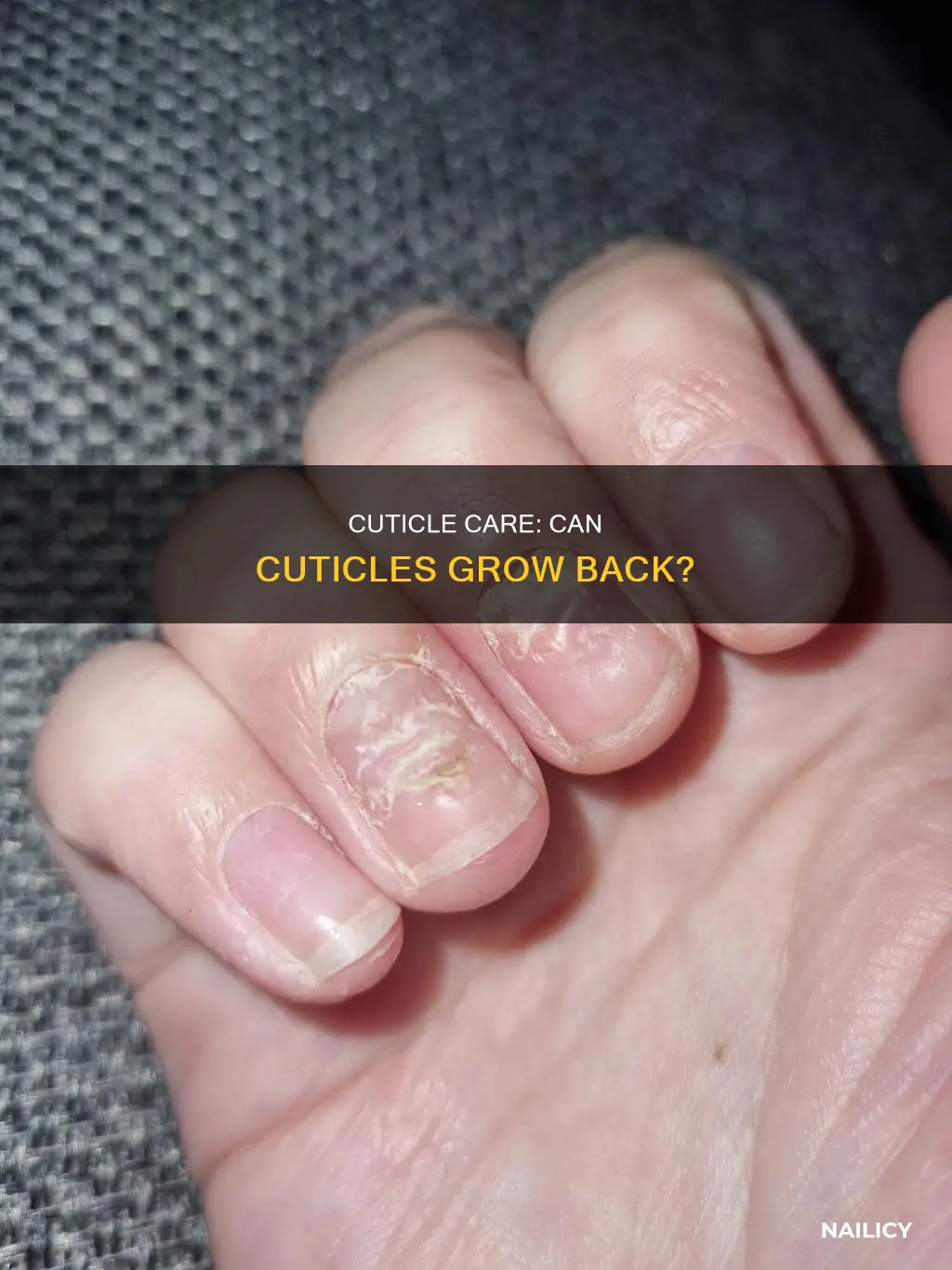 does nail cuticle grow back