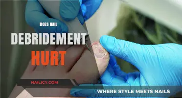 Does Nail Debridement Hurt? Pain Expectations and Relief Tips