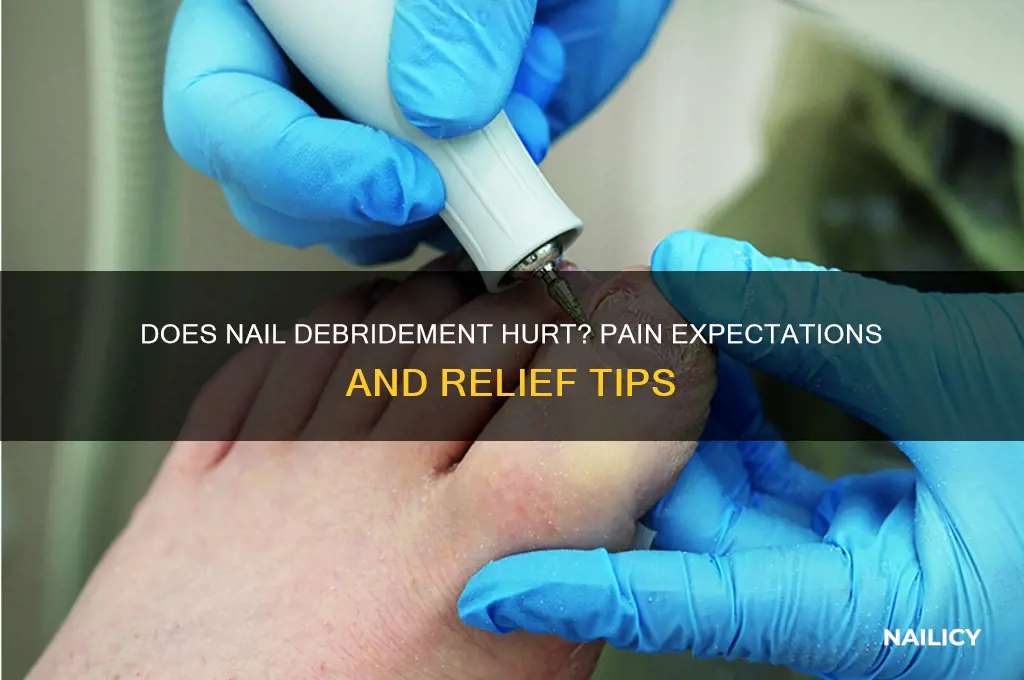does nail debridement hurt