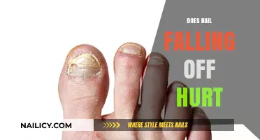 Does Losing a Nail Hurt? Understanding the Pain and Healing Process