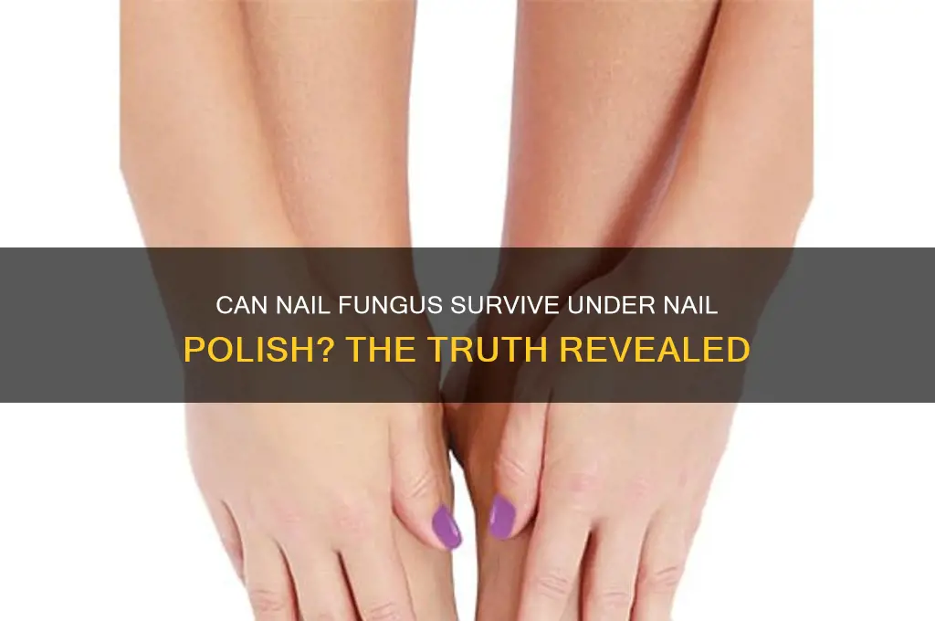 does nail fugus survive in nail polish