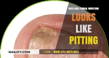 Nail Fungal Infections vs. Pitting: Spotting the Differences