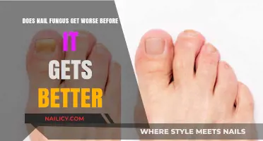 Understanding Nail Fungus: The Journey to Recovery
