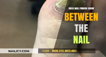 Nail Fungus: What's Lurking Between Your Nails?