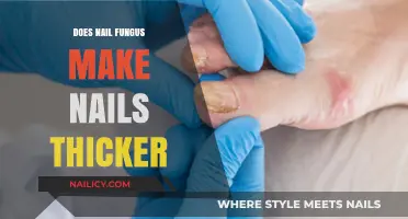 How Nail Fungus Causes Thicker Nails