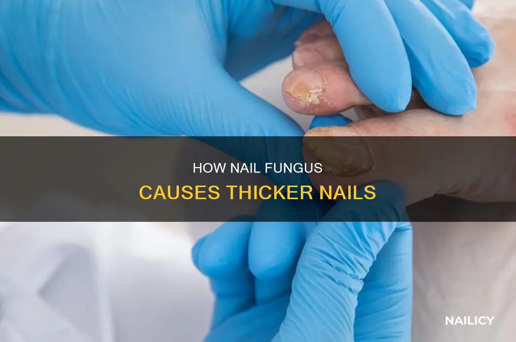 does nail fungus make nails thicker