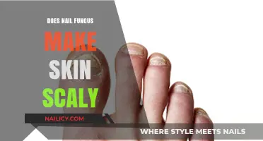 Nail Fungus: Skin Scaly Symptoms and Their Causes