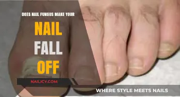 Nail Fungus: Can It Cause Nails to Fall Off?