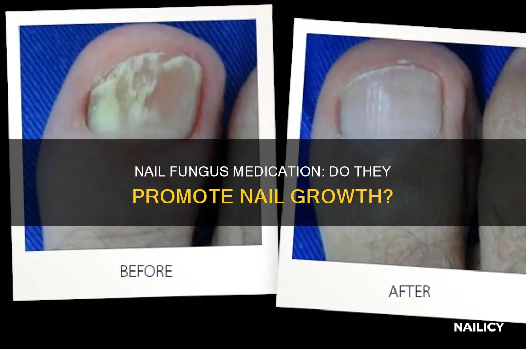 does nail fungus medication make your nails gro fast