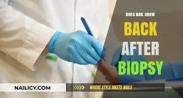Will Nails Regrow After a Nail Biopsy?