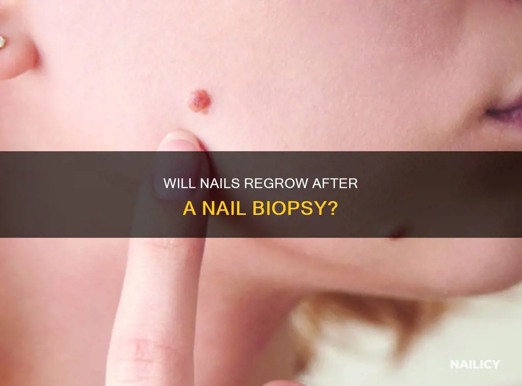 does nail grow back after biopsy