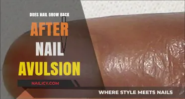 Will Nails Grow Back After Avulsion Surgery?