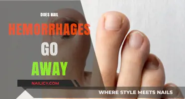 Do Nail Hemorrhages Heal? Understanding Causes, Treatment, and Recovery