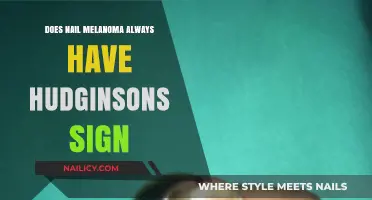 Does Nail Melanoma Always Show Hutchinson's Sign? Facts Revealed