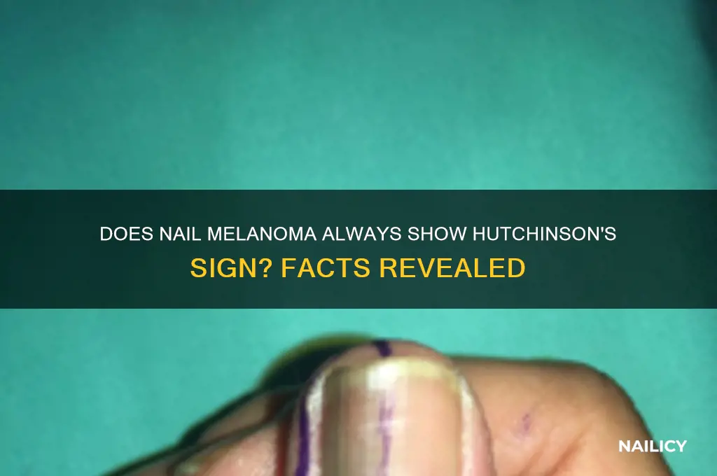 does nail melanoma always have hudginsons sign