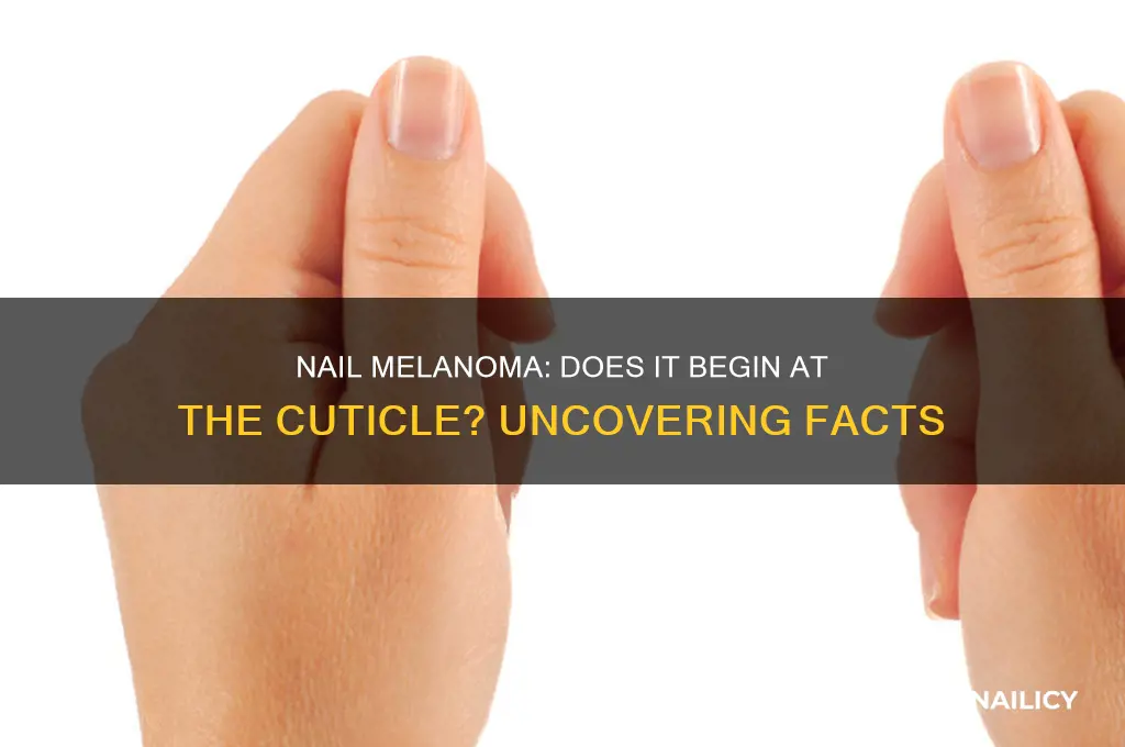 does nail melanoma start at the cuticle