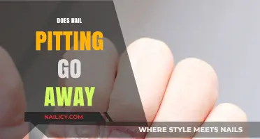 Can Nail Pitting Be Reversed? Understanding Causes and Treatment Options