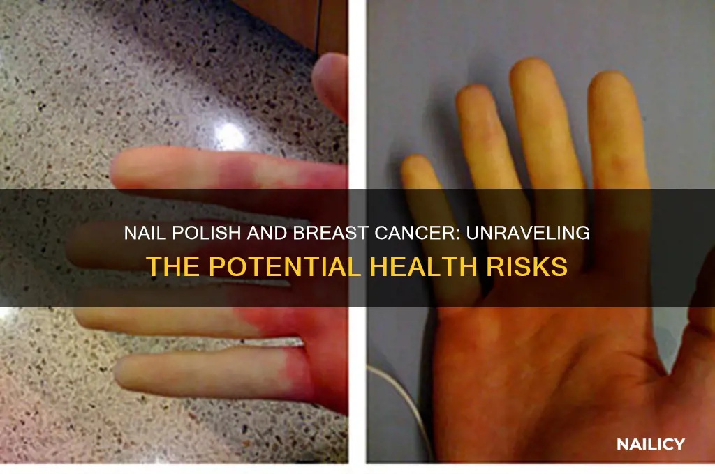 does nail polish cause breast cancer