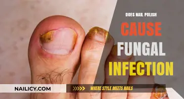 Nail Polish and Fungal Infections: Separating Fact from Fiction