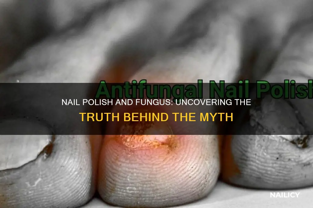 does nail polish cause nail fungus