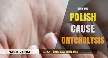 Nail Polish and Onycholysis: Uncovering the Truth Behind the Myth