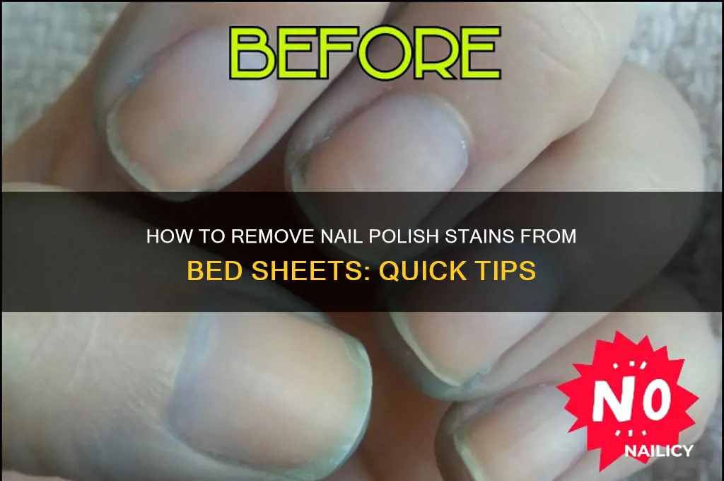 does nail polish come out of bed sheets