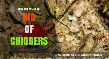 Natural Remedies for Chiggers: Does Nail Polish Really Work?
