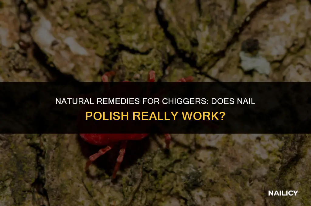 does nail polish get rid of chiggers