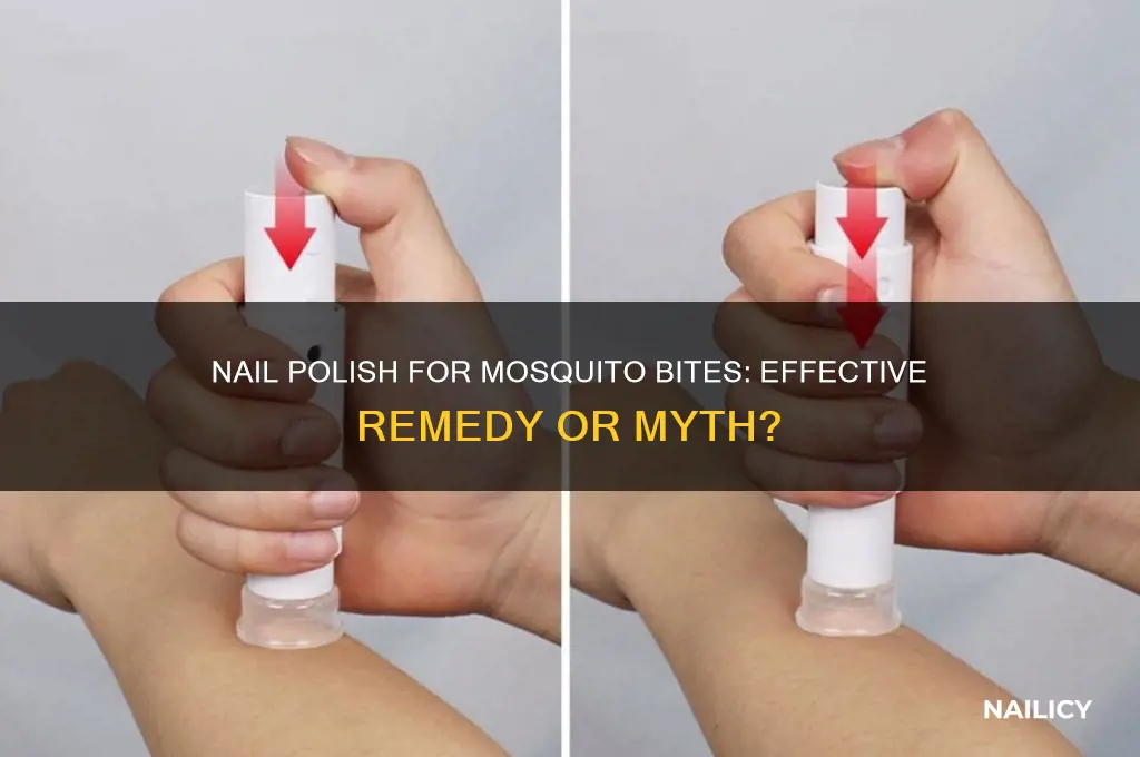 does nail polish help mosquito bites