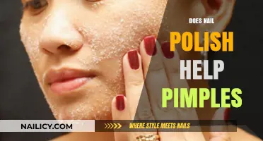 Can Nail Polish Clear Pimples? Uncovering the Truth Behind the Trend
