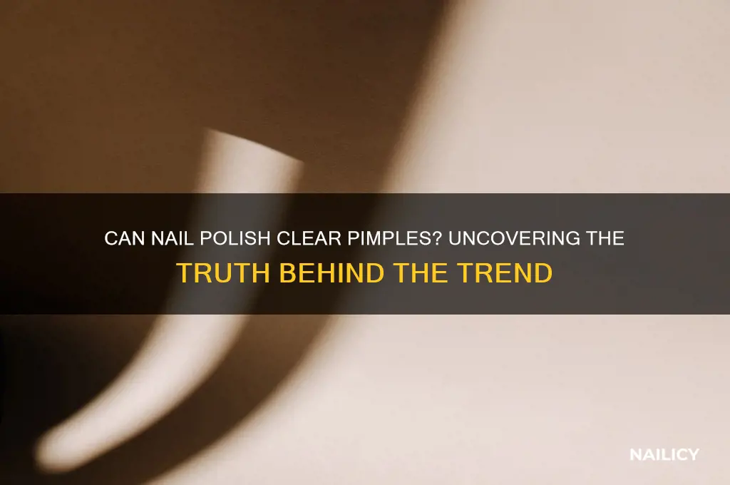 does nail polish help pimples