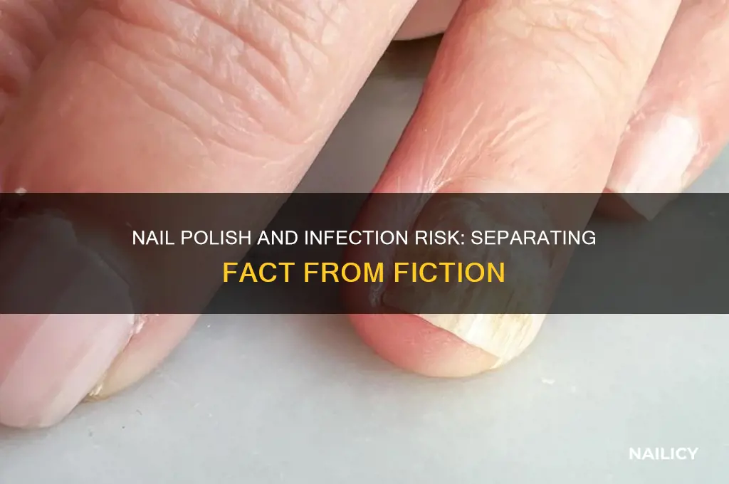 does nail polish increase risk of infection