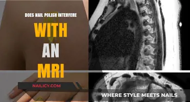 Nail Polish and MRI Scans: Safety Concerns and Precautions