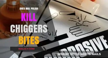 Nail Polish Remedy: Can It Soothe or Kill Chigger Bites?