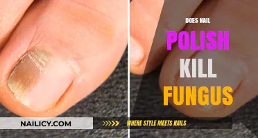 Can Nail Polish Effectively Treat or Kill Fungal Infections?