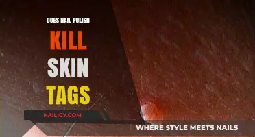 Can Nail Polish Safely Remove Skin Tags? Facts and Risks Explained