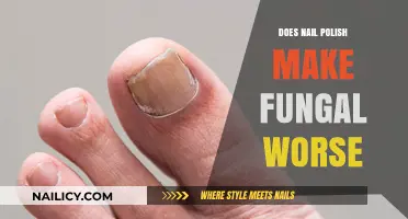 Can Nail Polish Aggravate Fungal Infections? Uncovering the Truth