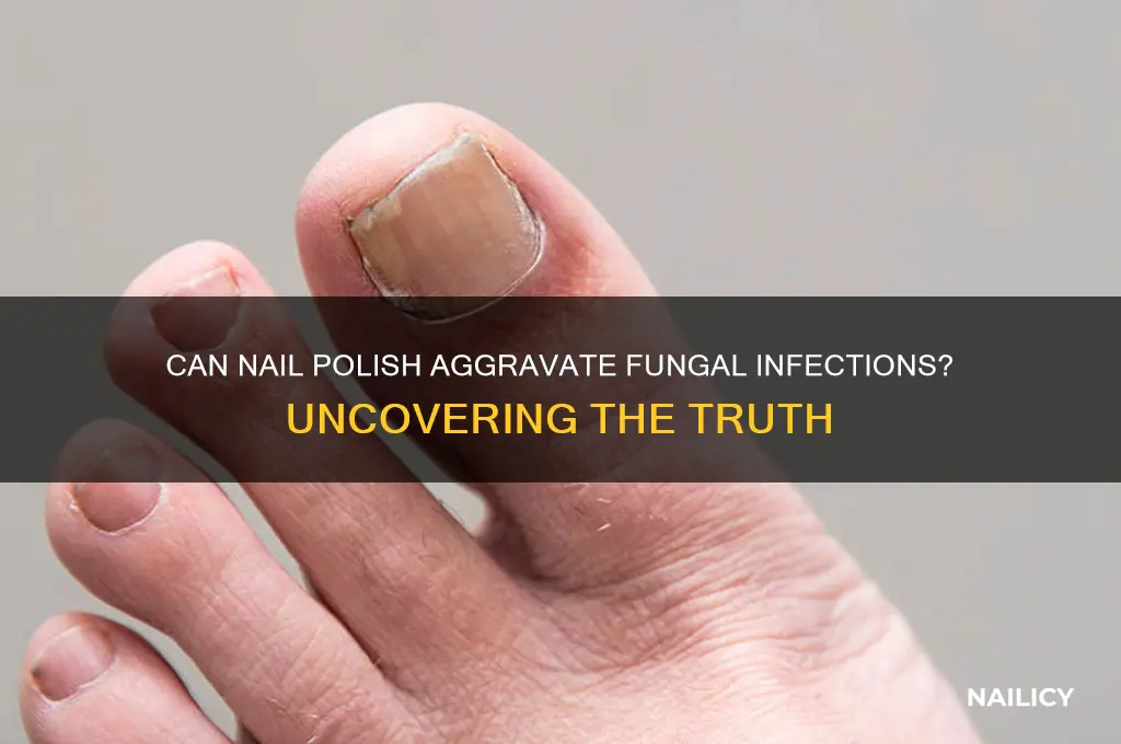 does nail polish make fungal worse