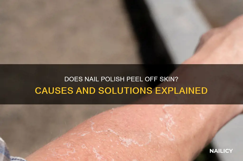 does nail polish peel off skin
