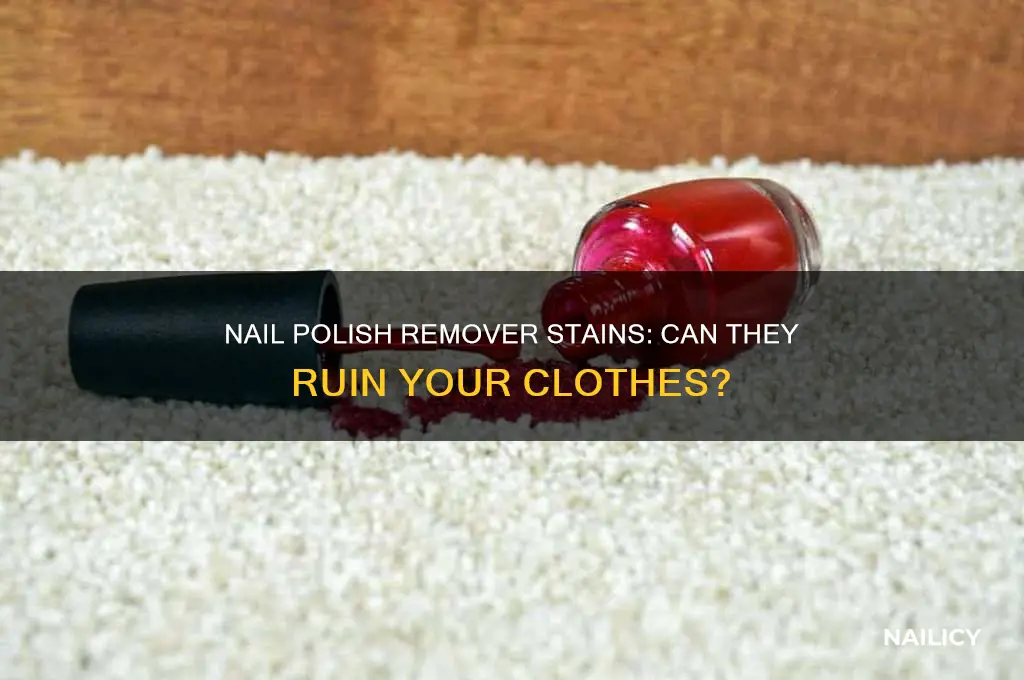 does nail polish remoover stain clothes
