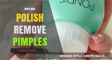 Nail Polish: A Pimple Remedy or Myth?