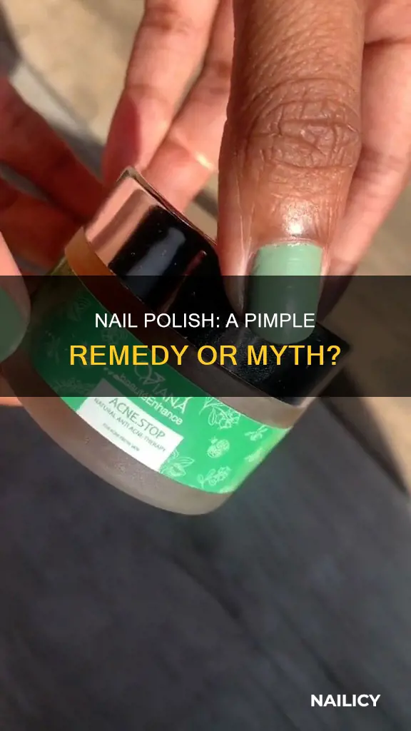 does nail polish remove pimples