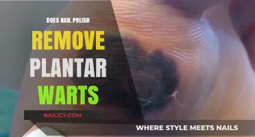 Nail Polish: Effective Remedy for Plantar Warts?
