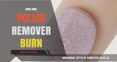 Nail Polish Remover: The Burning Question