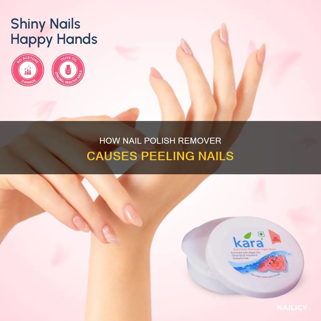 does nail polish remover cause peeling nails
