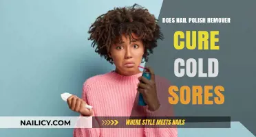Nail Polish Remover: Cold Sore Remedy or Myth?