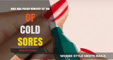 Debunking Myths: Can Nail Polish Remover Cure Cold Sores?