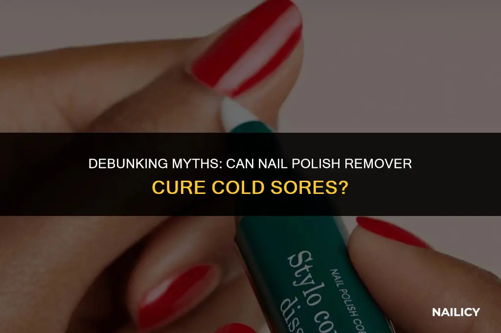 does nail polish remover get rid of cold sores